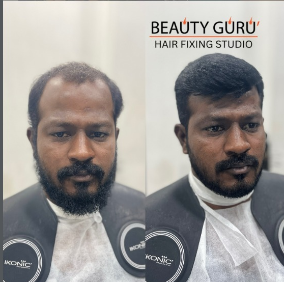 Hair Transformation 6